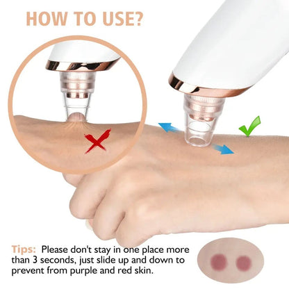Electric Blackhead Remover, Vacuum Acne Cleaner, Black Spots Removal Device, Pore Cleaner Machine, Skin Care Tools, 5 Heads Suction Machine,  Vacuum Electric Black Head Extractions Tool, Electric Facial Pore Cleaner, Exfoliating Beauty Device